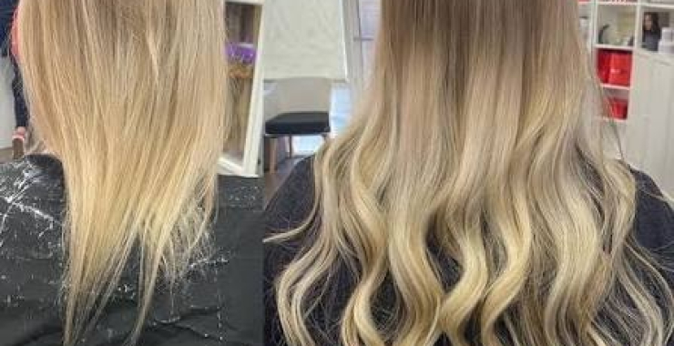 Book Online Private Hair Loss Consultation in Dallas