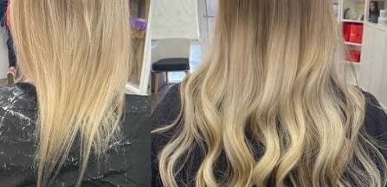 Book Online Private Hair Loss Consultation in Dallas